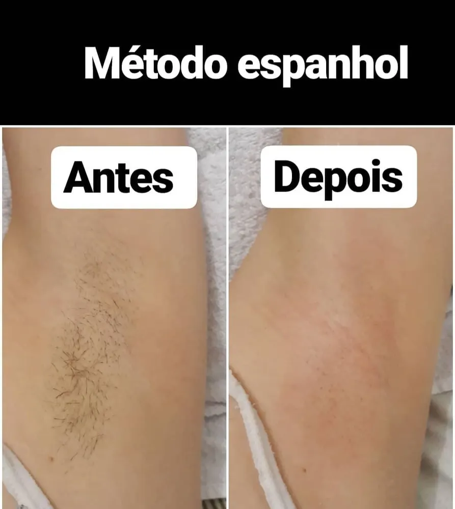 Ana Dolinski Depilação — foto 2