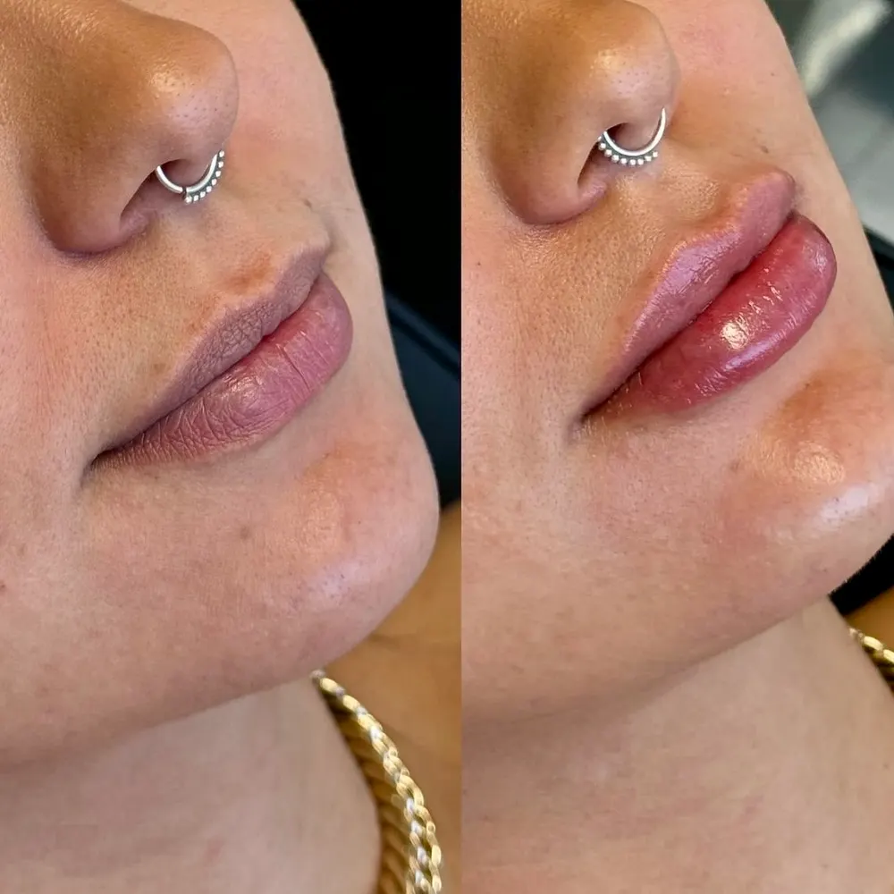Ana Pohlmann Estética Avançada — foto 1