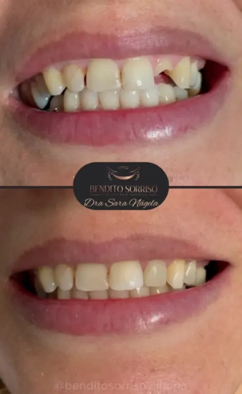 🥇 Clínica Odontológica Bendito Sorriso Vilhena — foto 1