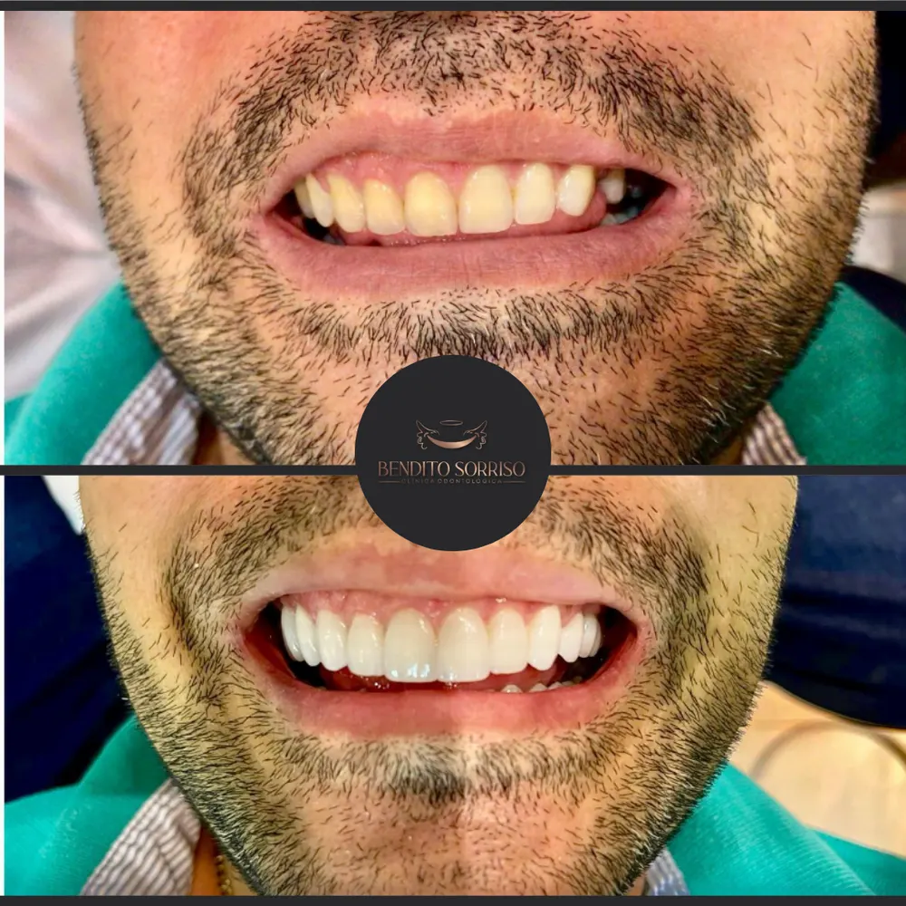 🥇 Clínica Odontológica Bendito Sorriso Vilhena — foto 2