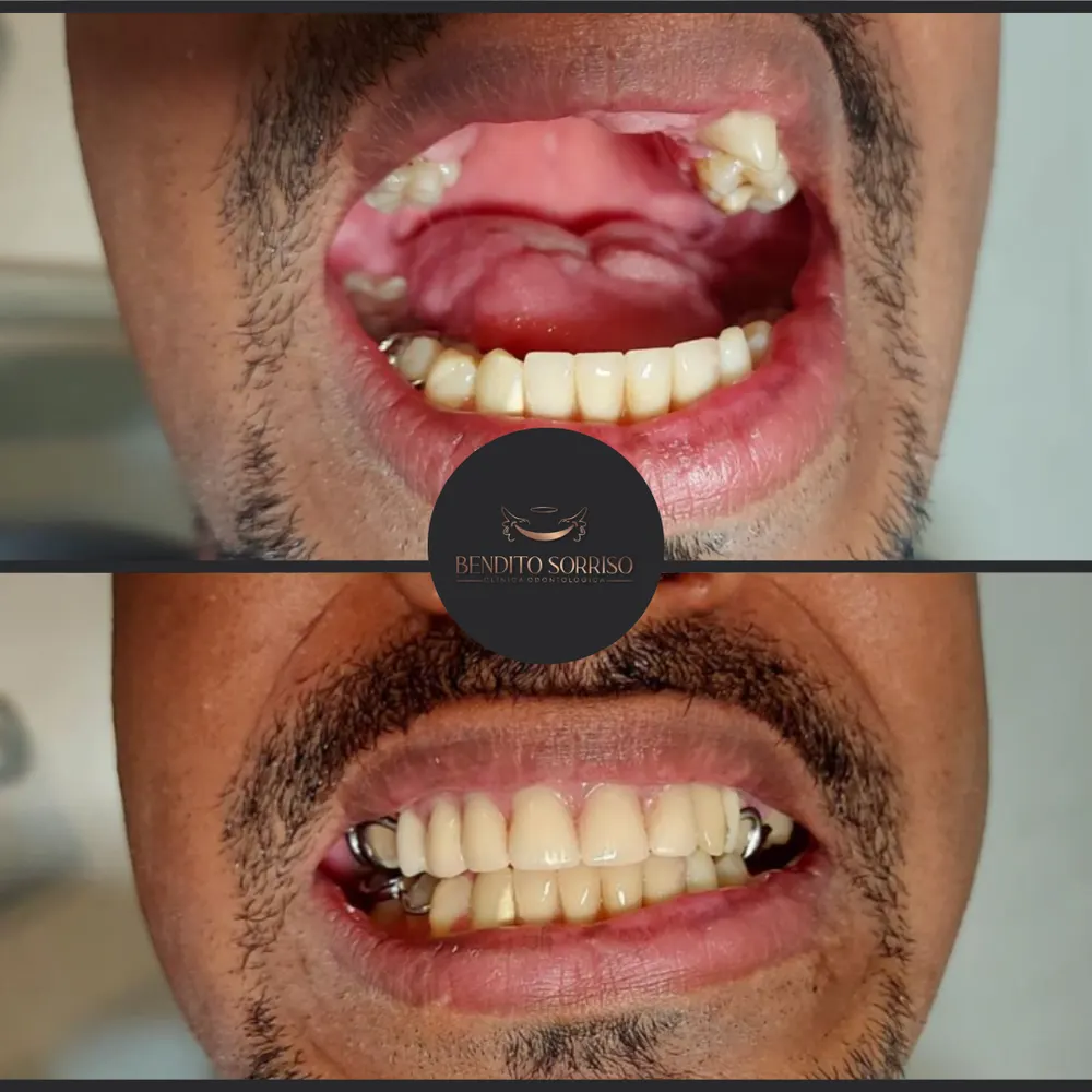 🥇 Clínica Odontológica Bendito Sorriso Vilhena — foto 3