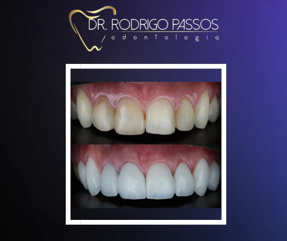 Dr Rodrigo Passos Odontologia — foto 5