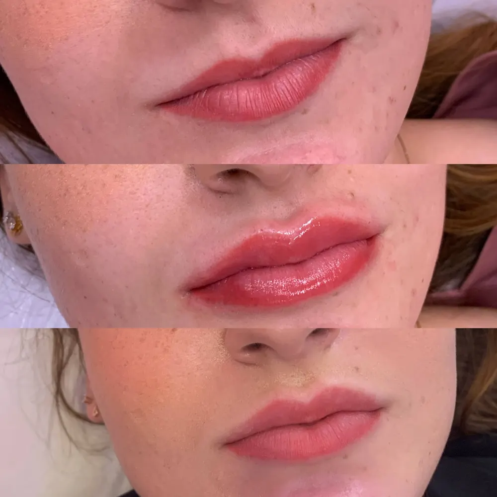 Dra Maiane Miranda - Estética Avançada — foto 3