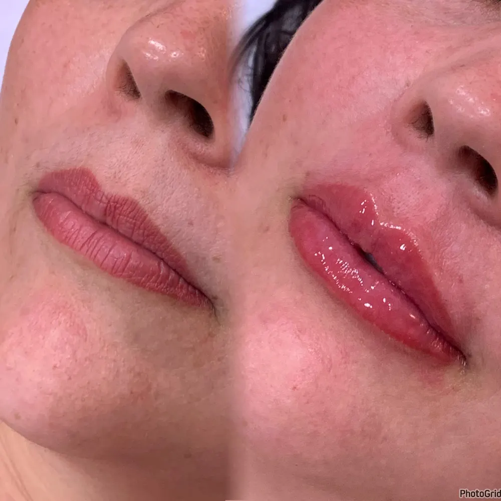 Dra Maiane Miranda - Estética Avançada — foto 4