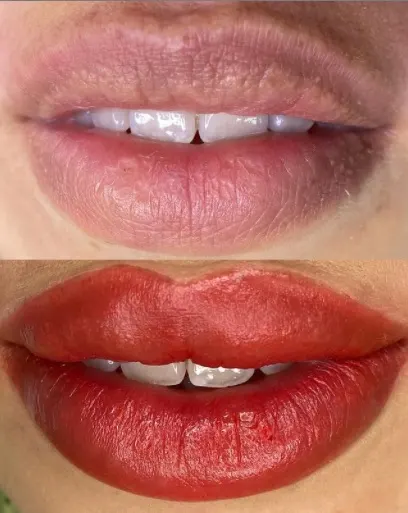 Finesse Clínica Estética — foto 3