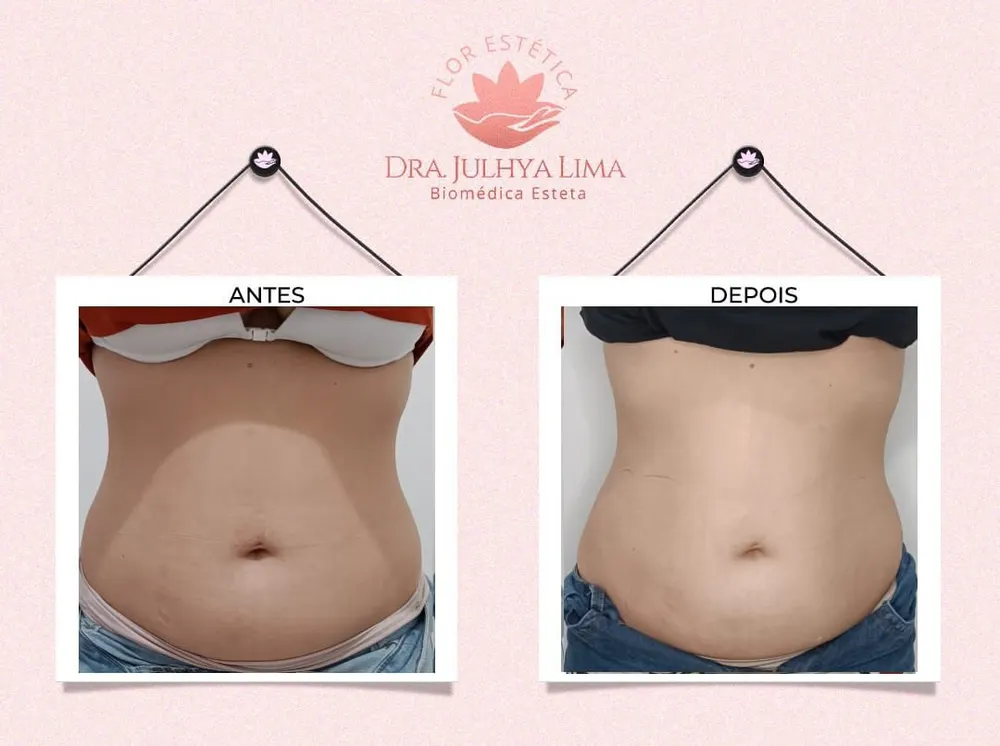 Flor Estética — foto 6