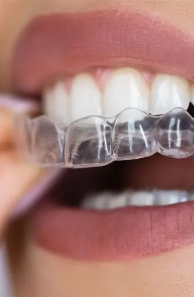 Lis Odontologia | Ortodontia e Alinhadores — foto 1