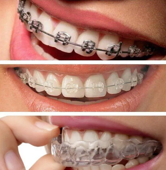 Lis Odontologia | Ortodontia e Alinhadores — foto 2