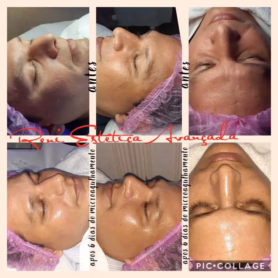 Reni Câmara Estética Avançada