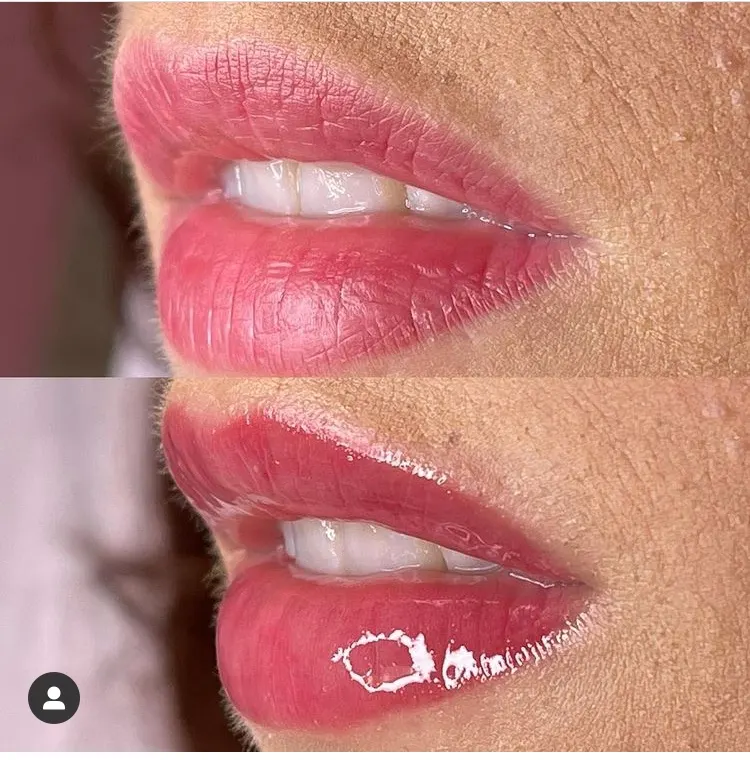 Seidy Suellen Estética — foto 2