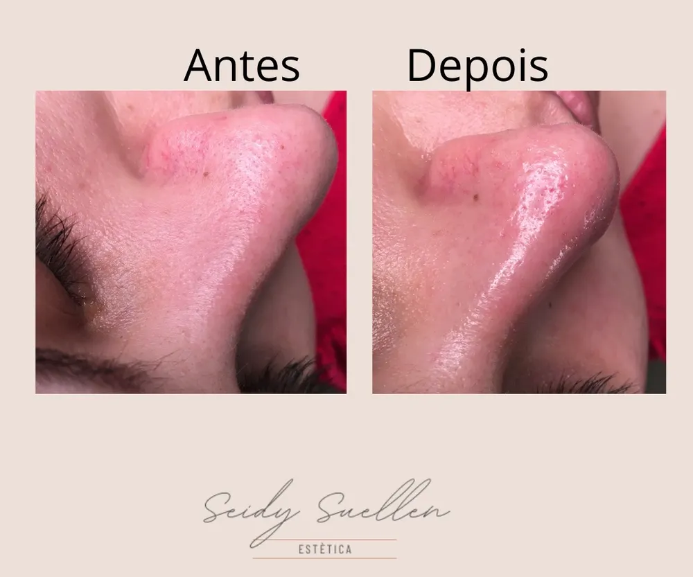 Seidy Suellen Estética — foto 1