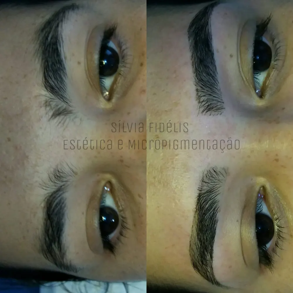 Sílvia Fidélis - Estética e Micropigmentação — foto 1