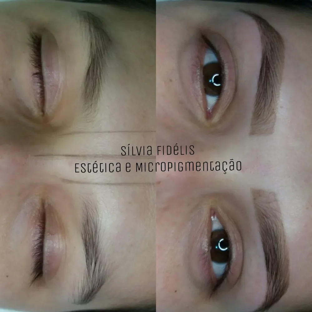 Sílvia Fidélis - Estética e Micropigmentação — foto 3